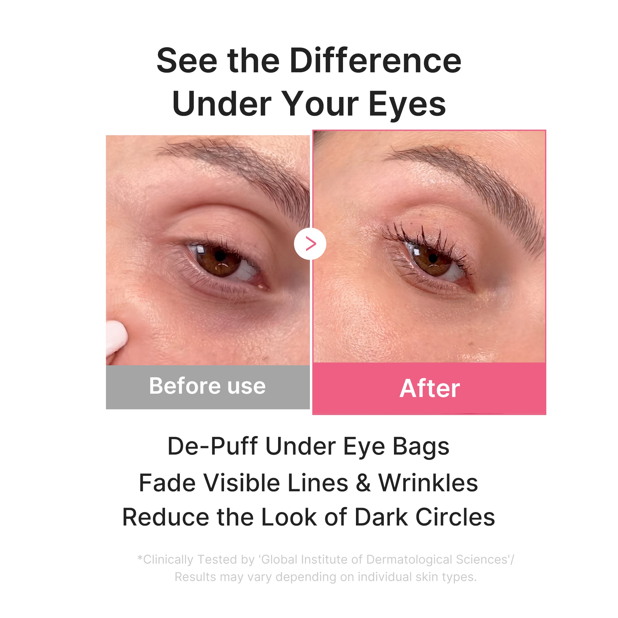 Medicube PDRN Pink Collagen Jelly Eye Mask
